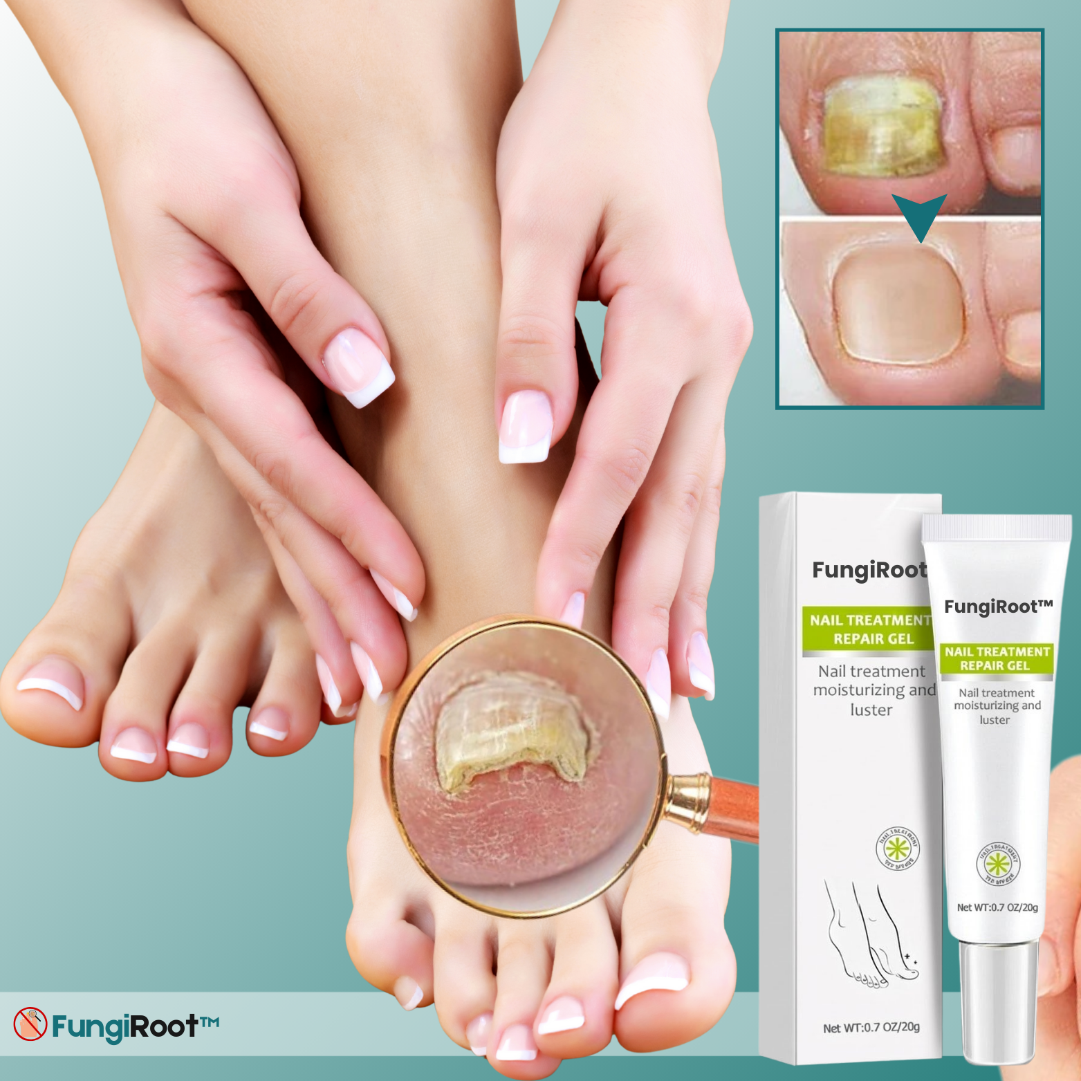FungiRoot™ Nagelreparatur-Behandlungsgel
