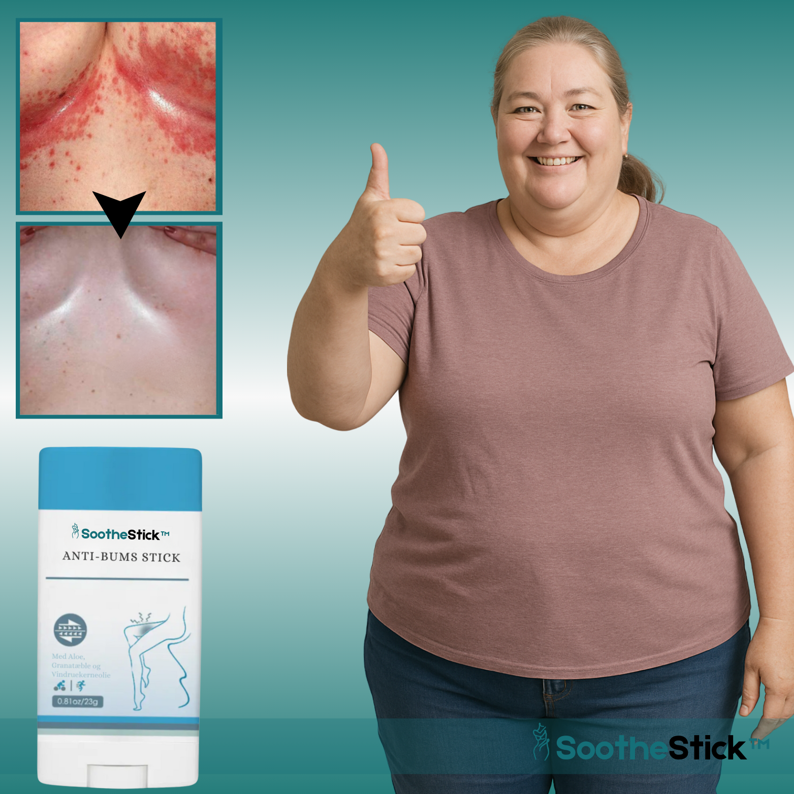 SootheStick™ Sofort-Hautlinderungs-Stick