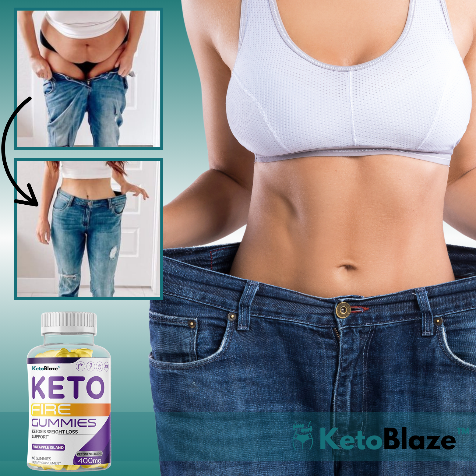 KetoBlaze™ Fettverbrennende Keto-Gummibärchen