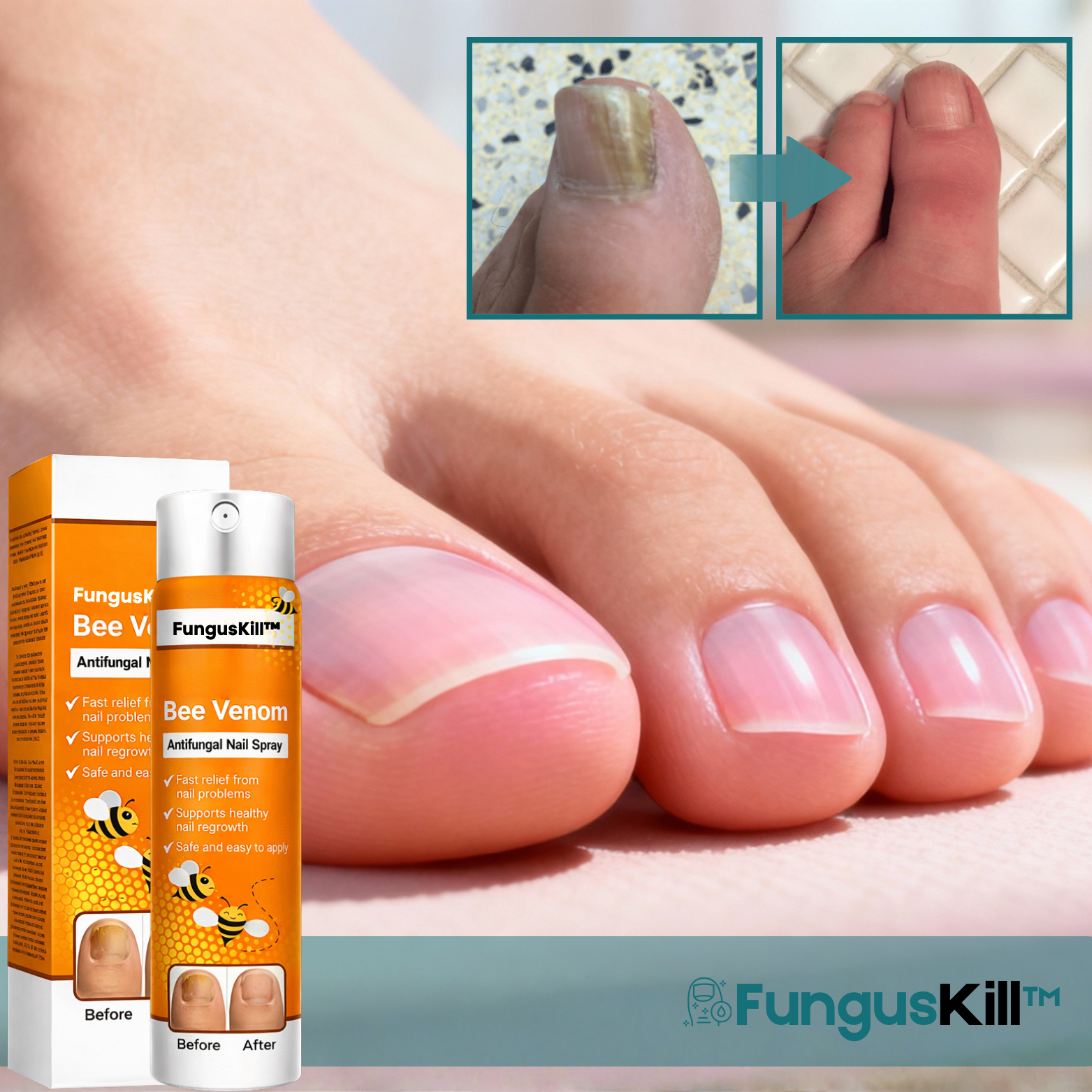FungusKill™ Antipilz Nagelspray