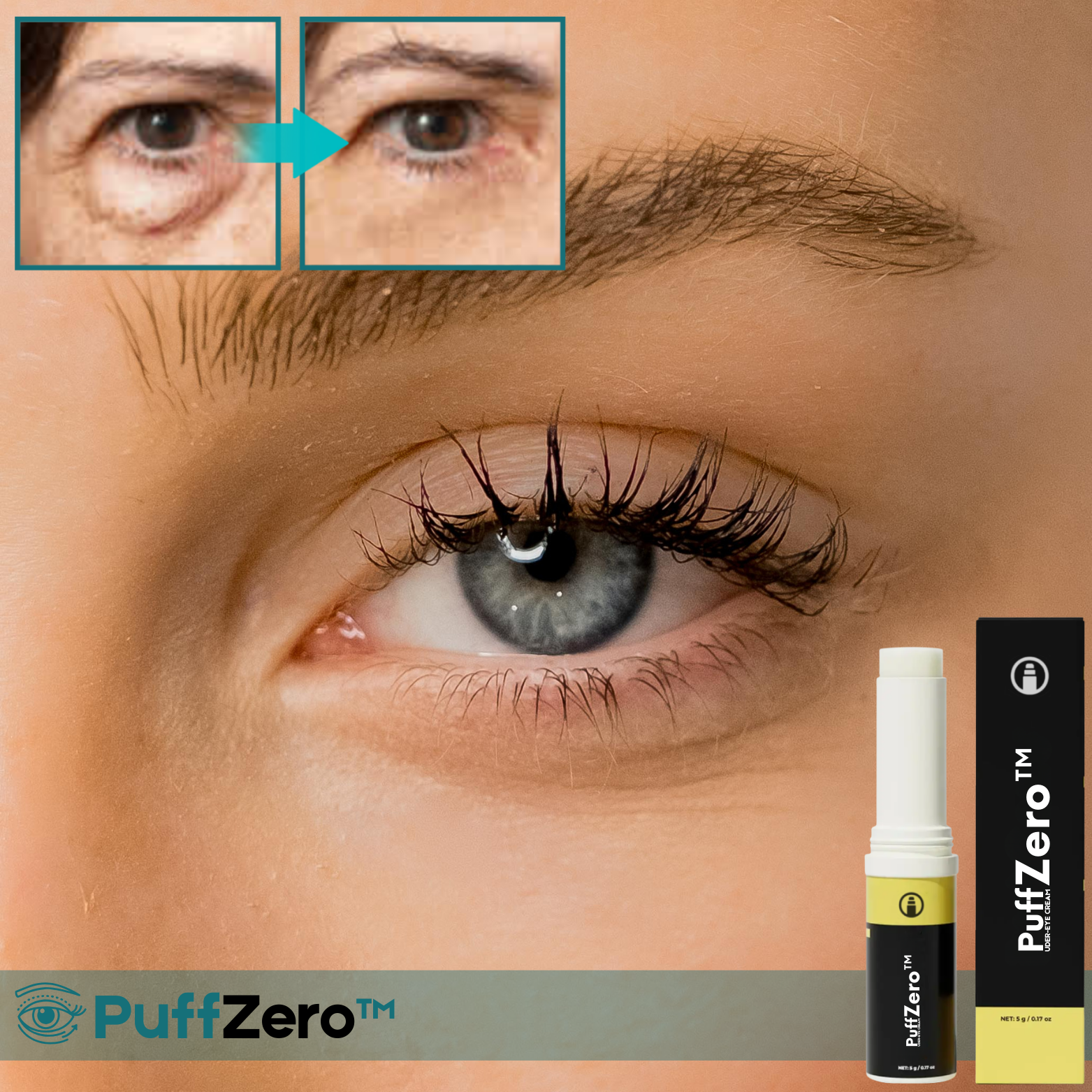 PuffZero™ Sofort-Augenbalsam