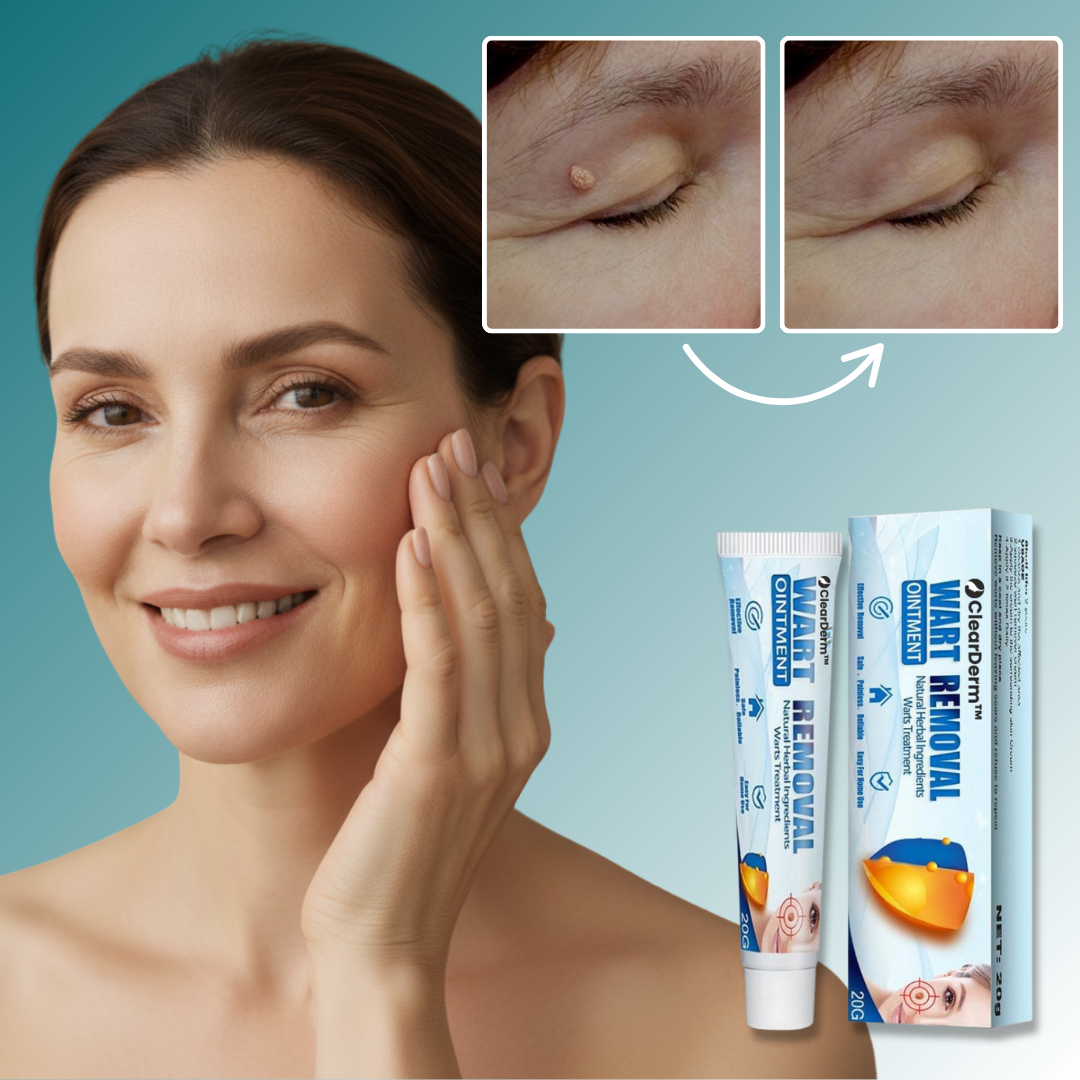 ClearDerm™ Warzencreme