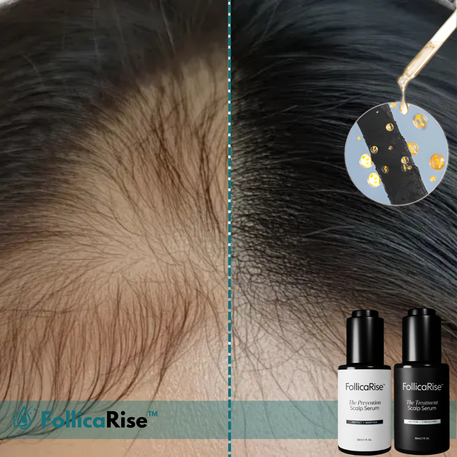 FollicaRise™ Haarwachstums-Kopfhautserum
