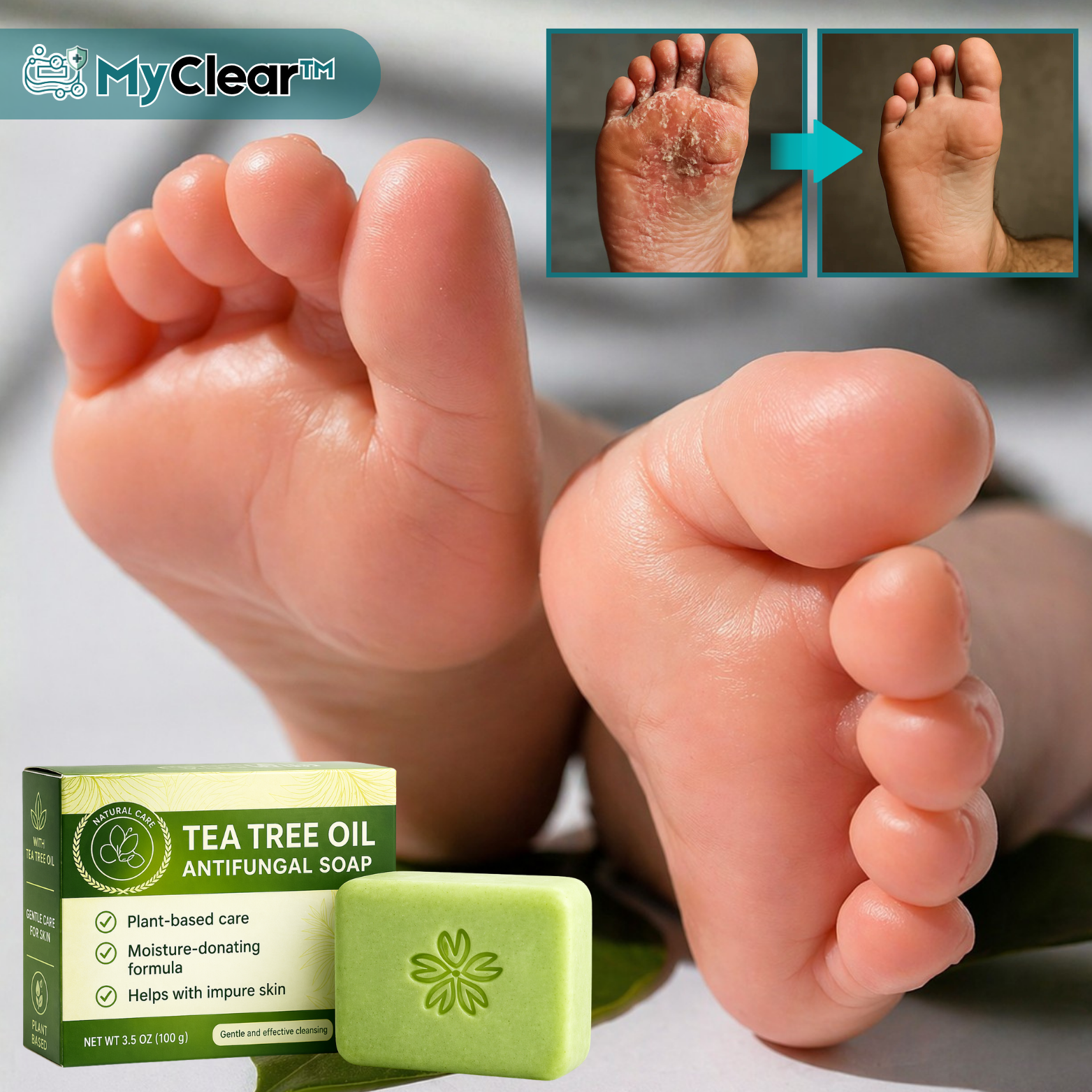 MyClear™ Anti-Pilz-Seife