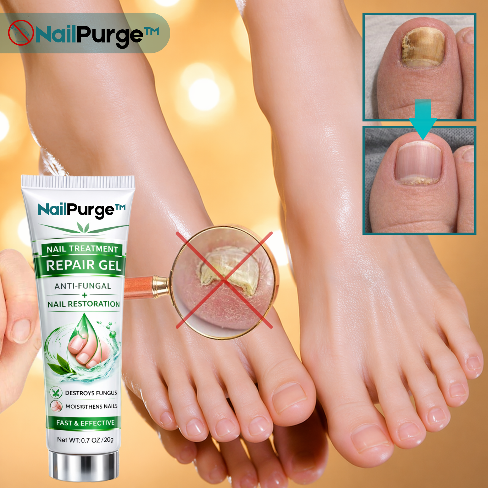 NailPurge™ Nagelreparatur-Gel